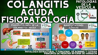 COLANGITIS FISIOPATOLOGÍA  GuiaMed [upl. by Amsa]