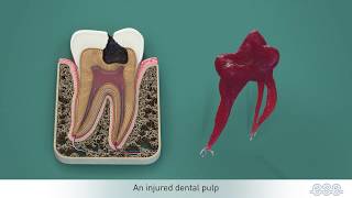 Endodontic treatments [upl. by Aip]