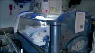 Cancer Patients Treated With Hyperbaric Oxygen [upl. by Boggers614]