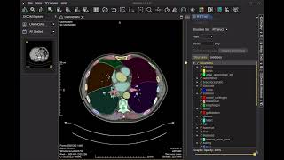 Displaying TotalSegmentator segmentation results in Weasis [upl. by Arimas656]