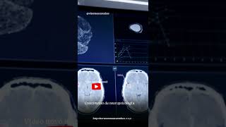 Crescimento da neuropsicologia [upl. by Riamu]