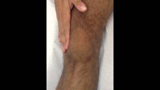 Knee Effusion Test  Selfassessment Swipe Test [upl. by Naicad]