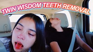 Identical Twins Get Wisdom Teeth Removed FUNNY [upl. by Artus273]