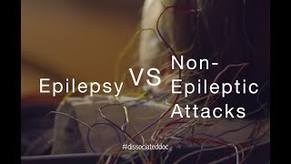 Epilepsy VS NonEpileptic Attacks Misdiagnosis amp Key Differences [upl. by Amzaj]