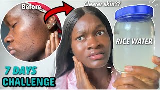 I used FARMENTED RICE WATER on my face for a week and this happened before and after results [upl. by Namyh]