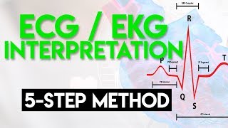 ECG Interpretation Made Easy  ECG EKG Interpretation Part 2 [upl. by Aisak960]