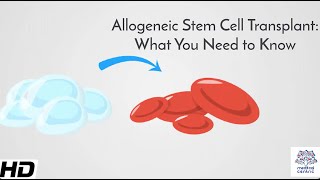 Allogeneic Stem Cell Transplant What You Need to Know [upl. by Collier663]