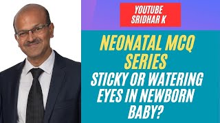 Sticky eyes in babies Nasolacrimal duct obstruction in babies Watering eyes in babies MCQ baby [upl. by Salb]