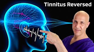 Tinnitus Reversed The Miracle of 1 Nutrient Dr Mandell [upl. by Gnok]