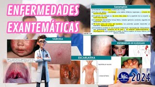 RM 24  Infectología Pediátrica Enfermedades Exantemáticas Estudios M Y C [upl. by Elmina171]