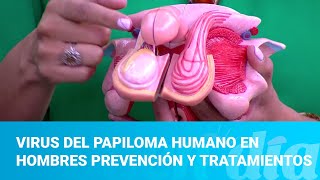 Todo lo que debes saber sobre el Virus del Papiloma Humano VPH [upl. by Sirraj]