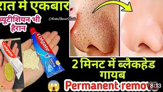 Close Large OPEN PORES Remove DARK SPOTS amp Blackheads Whiteheads get Glowing skin glowingskin [upl. by Aicsila983]