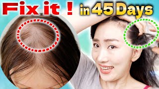 Scalp Lymphatic Drainage Massage to Improve Thinning Hair in 45 Days [upl. by Terryl653]