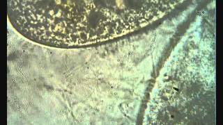 Paramecium trichocyst discharge [upl. by Elinet221]