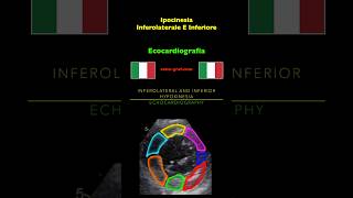 Ecocardiografia  Ipocinesia Inferolaterale E Inferiore [upl. by Llenwahs]