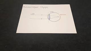 1 Erklärvideo Die Fehlsichtigkeiten Augenoptik [upl. by Nnail]