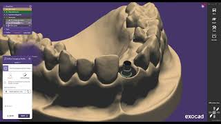 Exocad Elefsina 32 2024 New ASC Flex Features amp Angled Screw Channel Tutorial [upl. by Romalda616]