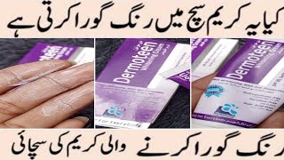 Dermoteen Whitening Cream  Medicated Whitening Cream 100  Results [upl. by Jason]