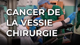 Cancer de la vessie  des techniques opératoires pour limiter la récidive et améliorer le traitement [upl. by Neliak]