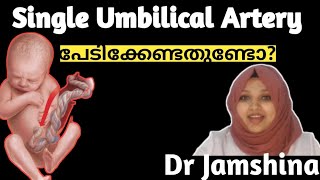 What is Single Umbilical ArteryShould I be Worried about my babies umbilical cord SUA Dr Jamshina [upl. by Haroved]