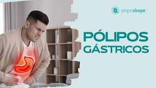 Pólipos gástricos  Clínica Angioskope [upl. by Karli]