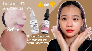 7 Days of using Miracle Repair Serum amp Power Glow Serum ng Luxe Organix Review  Lyza P [upl. by Lemor]