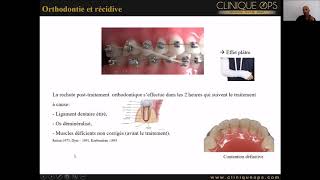 Partie 12  Le traitement Orthodontique nest pas efficace longtemps Préjugé ou vérité [upl. by Nossyla]