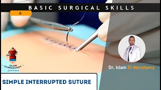 Simple interrupted suture [upl. by Atnicaj617]