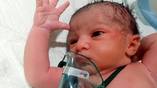 cute end neonate baby 🍼❤️😍🍼🍼🙂🍼❣️cutebaby newborn viral [upl. by Rock]