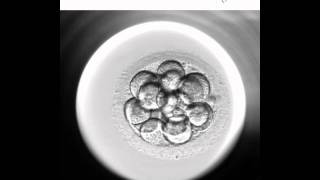 Embryoscope 2  Nuevo método de cultivo y selección embrionaria [upl. by Ahmar243]