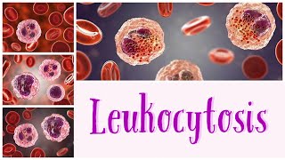 Leukocytosis hematology pathology pathologylab pathologyconcepts [upl. by Wonacott]