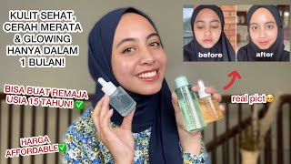 REVIEW JUJUR AVOSKIN YOUR SKIN BAE SEBAGUS APA HASILNYA [upl. by Isidoro]