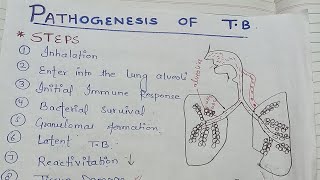 pathogenesis of tuberculosis NGMedicals [upl. by Norah]