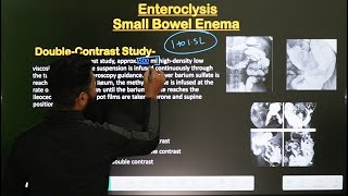 Small Bowel Enema  Enteroclysis Procedure  Part2  In Hindi  Radiological Procedure [upl. by Htinek]