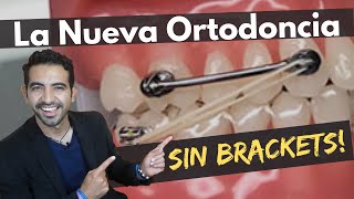 ORTODONCIA SIN BRACKETS  Tu Ortodoncia más rápida Más Estética y Más Cómoda Carriere Motion [upl. by Ignatzia]