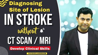 HOW TO DIAGNOSE SITE OF LESION IN STROKE WITHOUT CTSCAN  MRI [upl. by Iline]