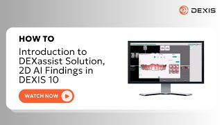 DEXIS™ Imaging Suite  Introduction to DEXassist Solution 2D AI Findings in DEXIS 10 [upl. by Azilanna]