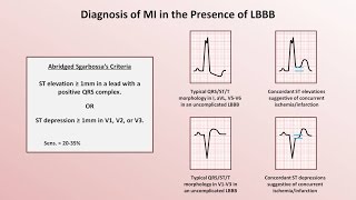 Intro to EKG Interpretation  Myocardial Infarctions Part 2 of 2 [upl. by Htebsle]