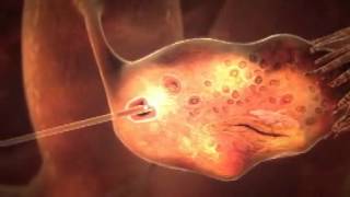 3D animation of how IVF works YouTube [upl. by Fredra]