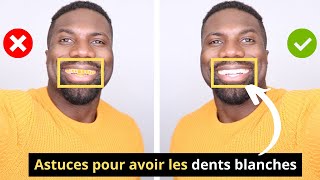 Blanchir Les Dents En 2 Minutes  Voici Comment Dents Blanches Et Brillantes Comme Des Perles [upl. by Alecia]