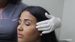 Mesoestetic Microblading Chantilly Curacao [upl. by Isyak]