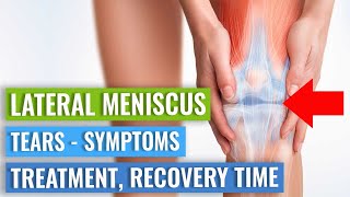 LATERAL Meniscus Tears Symptoms Treatment Surgery vs Exercise amp Recovery Time [upl. by Lock]