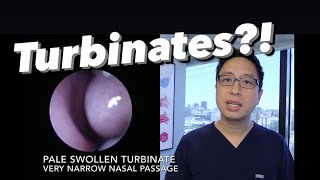 Inferior Turbinates what are they why do they swell stuffy nose congestion how do we treat [upl. by Mullen]