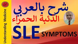 Systemic lupus erythematosus  SLE SYMPTOMS شرح بالعربي الذئبة الحمراء الأعراض [upl. by Sirapal]