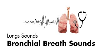 Bronchial Breath Sounds  Lung Sounds  Medzcool [upl. by Tabina]