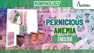 Pernicious Anemia  Histo pathology  RBC Morphology  English [upl. by Isidora]