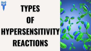 TYPES OF HYPERSENSITIVITY REACTIONS  Types 14 [upl. by Bibi]