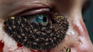 ASMR Removal Eye  ASMR Treatment Eye Maggots Animation  asmr video [upl. by Jerol]