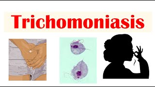 Trichomoniasis Common STI  Causes Symptoms amp Complications Cancer Diagnosis Treatment [upl. by Huang]