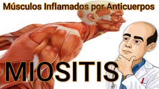 Polimiositis y Dermatomiositis 🙄🙄Músculos Inflamados por Culpa de Nuestros Anticuerpos😥😥USMLE [upl. by Chor]